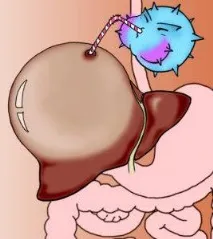 Вірусний гепатит – симптоми, лікування, вакцинація, профілактика, класифікація, діагностика, гострий лікування