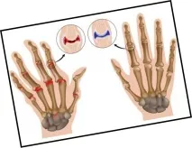 лівій