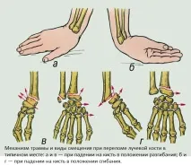 причини