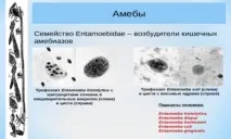 чревна представлява