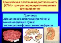 еритропоетин костния мозък