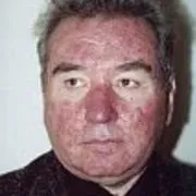 Фото демодекозу та відео про демодекс, картинки відео