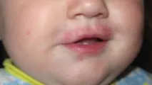 върху устната