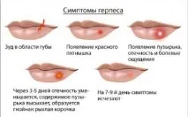 Герпес під час вагітності вагітності