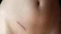 индикации индикации