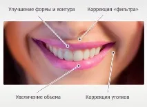 Ювідерм Ультра Смайл(Juviderm Ultra Smile) ціна та відгуки, Портал Естетика ювідерм