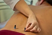 Лікування міозиту акупунктура саморозвиток і здоров’я акупунктура