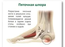 петата средства