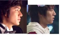 Лі Мін Хо - ДО та ПІСЛЯ пластики - K-POP k-pop