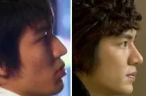 Лі Мін Хо - ДО та ПІСЛЯ пластики - K-POP k-pop