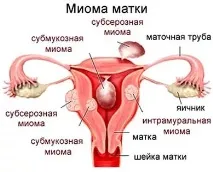 таке