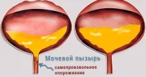 уринарна уринарна
