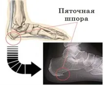 патологичната област болкоуспокояващи