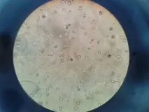 симптоми причини