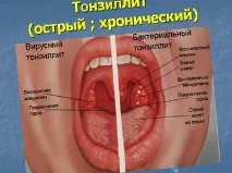 венците дома