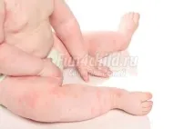 харчова