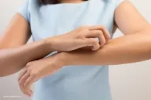 кожата сърбеж