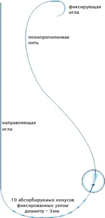 Підтяжка особи безопераційна - Обличчя - Центр пластичної хірургії лікаря В особи