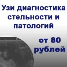 подидиплостомоза рибите