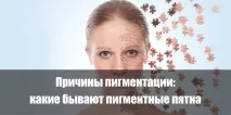 Причини пігментації які бувають пігментні плями. бувають