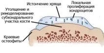 симптоми симптоми