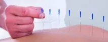 лекарства мигрена