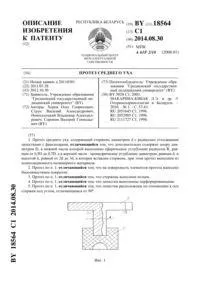 Протез середнього вуха - 18564 середнього