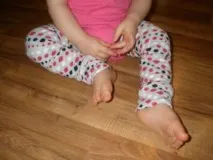 симптоми лечение