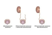 бъбреците агенезата