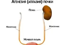 причините бъбреците