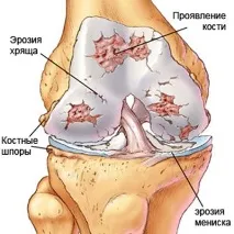 колянната става коляното