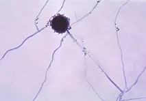 дихателната система рода Aspergillus