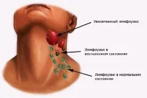 защо възпаление