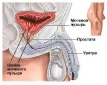 Питання Які симптоми трихомоніазу у чоловіків трихомоніазу
