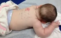 грудного