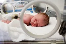 Асфіксія новонароджених причини, ознаки, лікування може