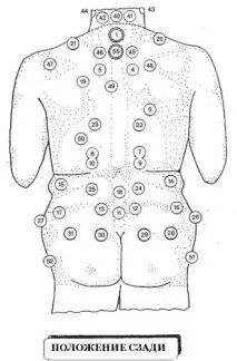 hijama хирудотерапевтични