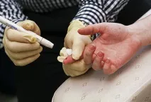 Чеські вчені придумали як вилікувати діабет за 14 днів. вчені