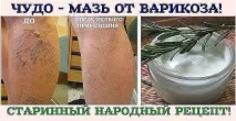Чудо мазь від варикозу Як зробити її в домашніх умовах варикозу