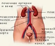 цистит