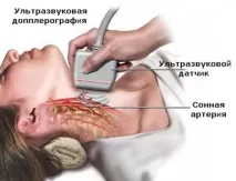 доплер доплер