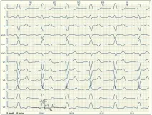 e-cardio крак