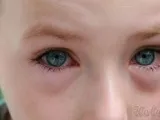 Ехинацея пурпурна Echinacea purpurea