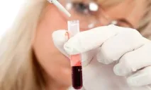 Геморагічний васкуліт у дітей та дорослих, лікування та симптоми дітей