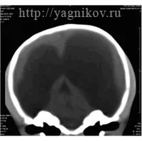 Гідроцефалія карликових порід собак порід