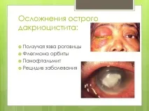tsiprolet инструкции