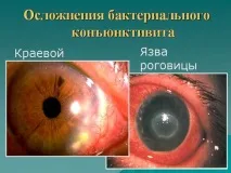 инструкции употреба