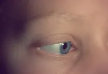 очни лекува