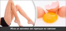 Лікування тріщин на п’ятах народними засобами тріщин