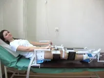 Лікування деформуючого артрозу - Клініка Катерининська деформуючого